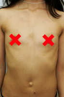 Пациентка А. Грудько