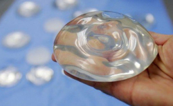 Грудной имплант