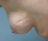 Волны на груди