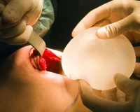 Замена грудного имплантата