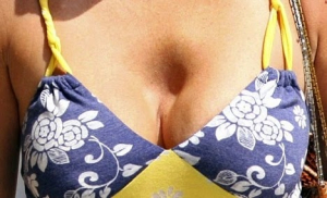 Капсулярная контрактура