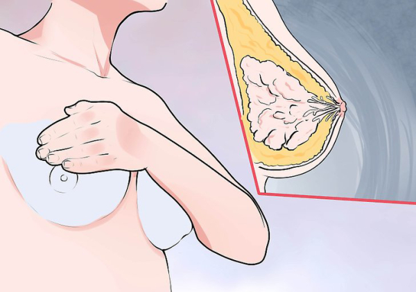 увеличение груди и рак