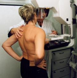 Обследование груди после маммопластики