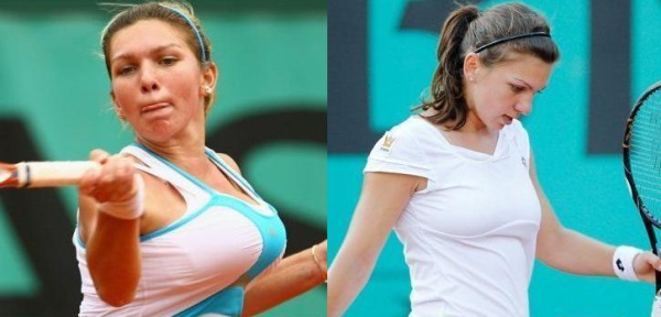 Теннисистка Симона Халеп до и после уменьшения груди