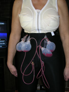 Дренаж после маммопластики