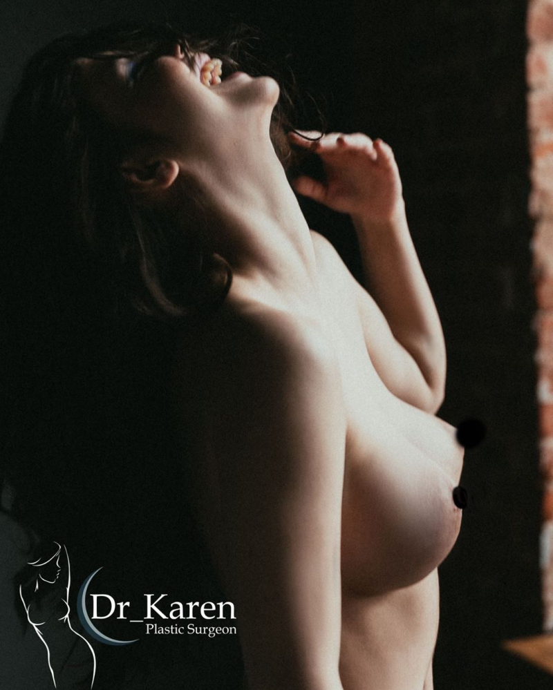 Пациентка доктора Пайтяна после маммопластики