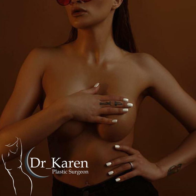 Фото пациентки доктора Карена Пайтяна после маммопластики