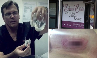 В Австралии поддельный пластический хирург калечил женщин