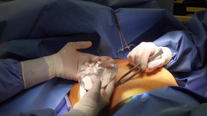 В течение недели после операции