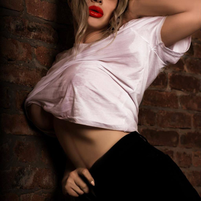 Пациентка доктора Карена Пайтяна через 5 месяцев после увеличения груди