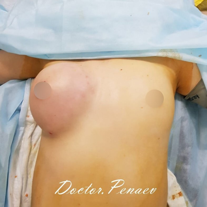 Пациентка пластического хирурга Арслана Пенаева