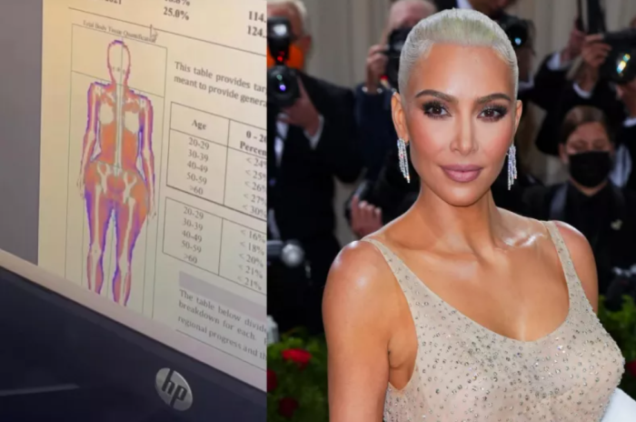 Ким Кардашьян рассекретила свою операцию по увеличению груди?