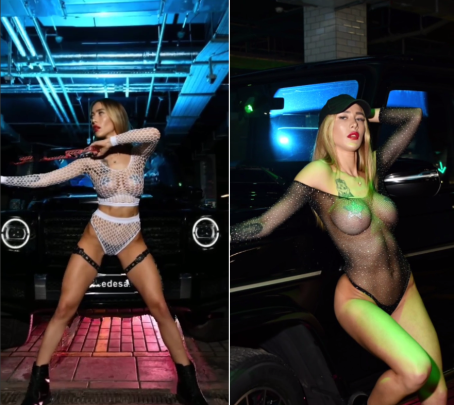 Пациентка пластического хирурга Гукаса Миракяна после увеличения груди