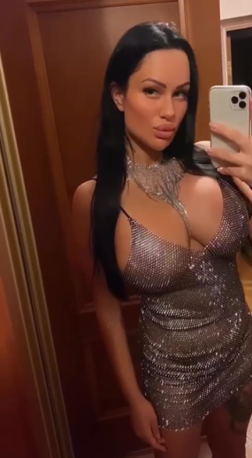 Пациентка московского пластического хирурга Гукаса Миракяна после увеличения груди имплантатами