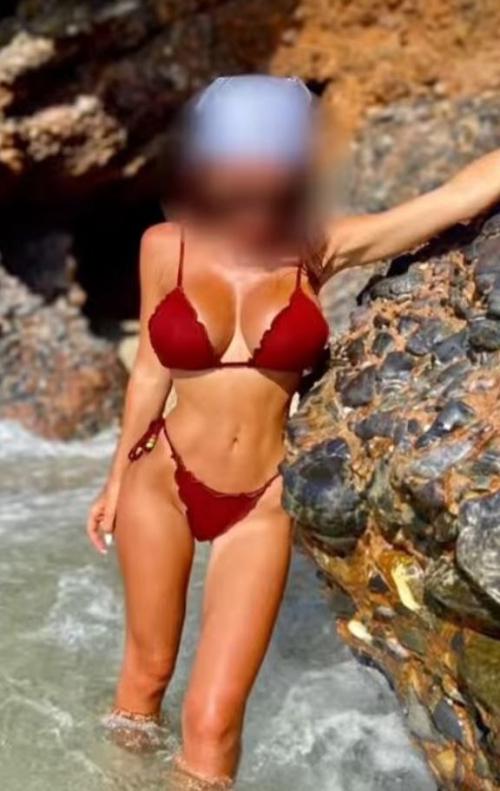 Пациентка пластического хирурга Гукаса Миракяна после увеличения груди в Москве