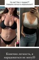 Наталья Фриске продемонстрировала результат маммопластики