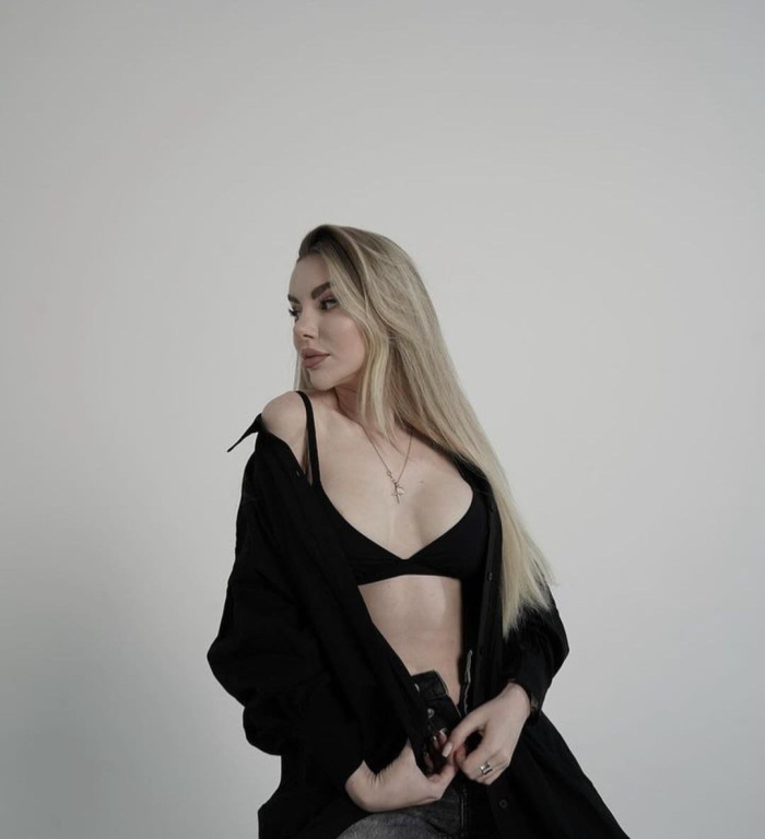 Пациентка после операции по увеличению груди имплантами. Оперировал доктор Гукас Миракян