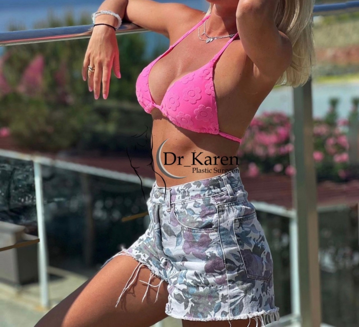 пациентка после увеличения груди